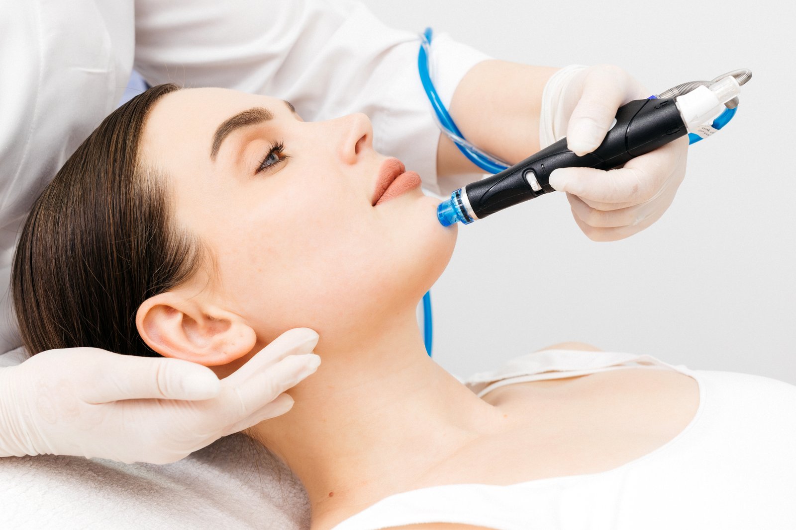 Cliente recibiendo tratamiento de hidrodermoabrasión